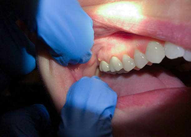 Best Weekend Emergency Dentist in East Hemet, CA