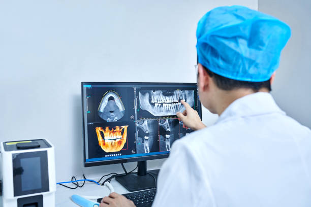 Best Emergency Dental Extractions in East Hemet, CA