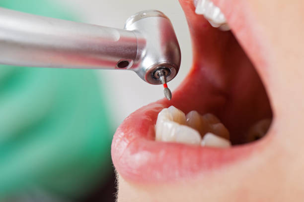Best Emergency Dentist for Special Needs Patients in East Hemet, CA